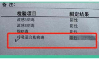 每天哈哈哈是什么症状 每天哈哈哈是什么症状